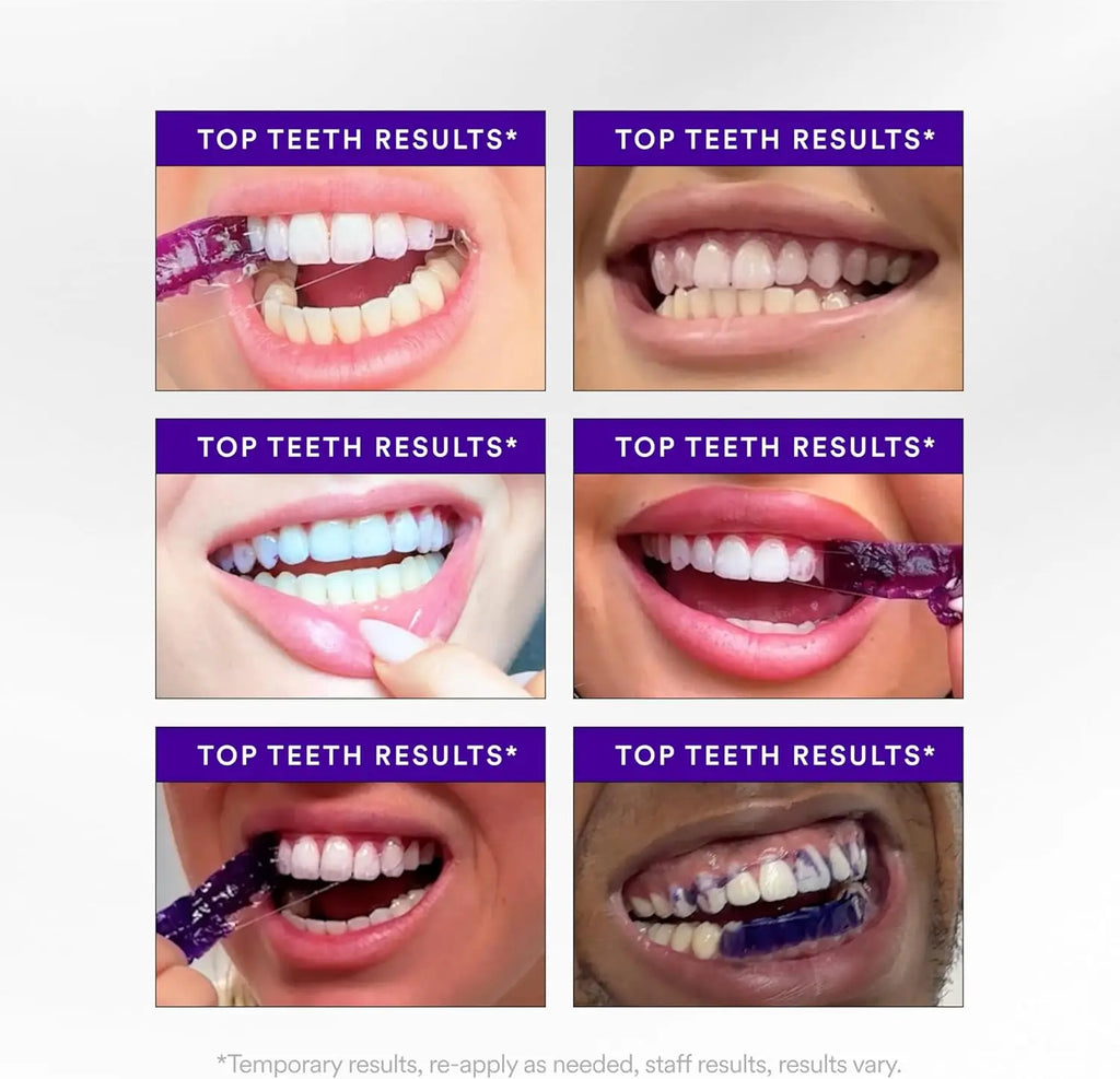 Purple Color-Correcting Teeth Whitening Strips