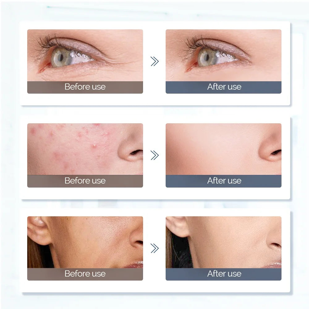 7-Color LED Light Therapy Face Mask — Red Light Skin Care Treatment